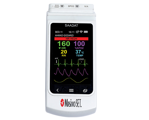 Wearable Monitor